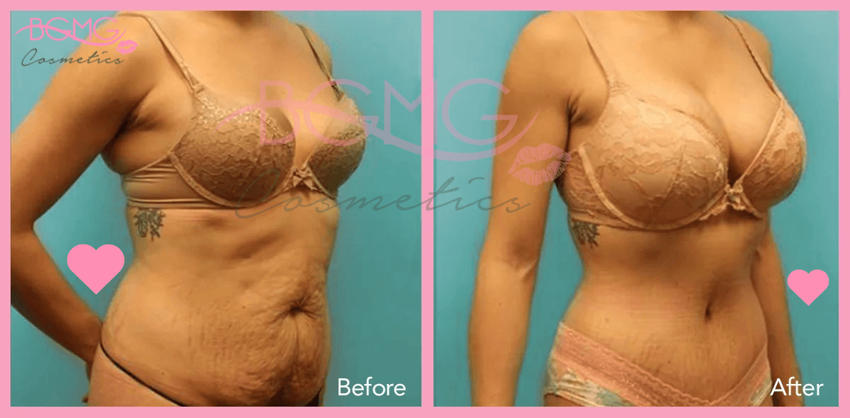 mummy makeover (2)