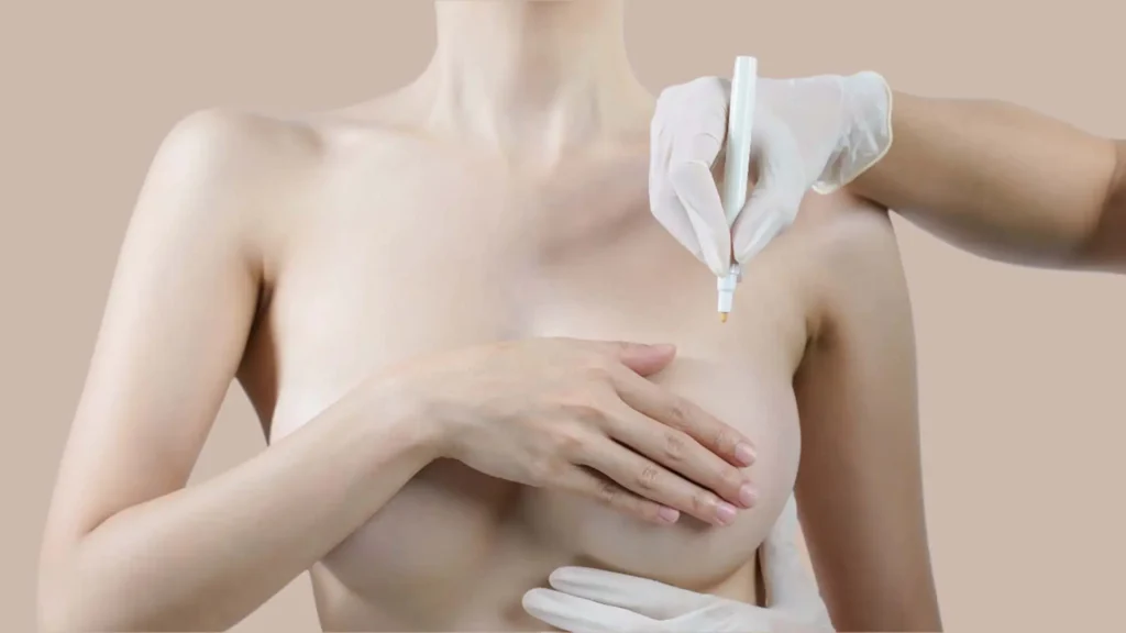 Ideal Candidates for Breast Reduction Surgery